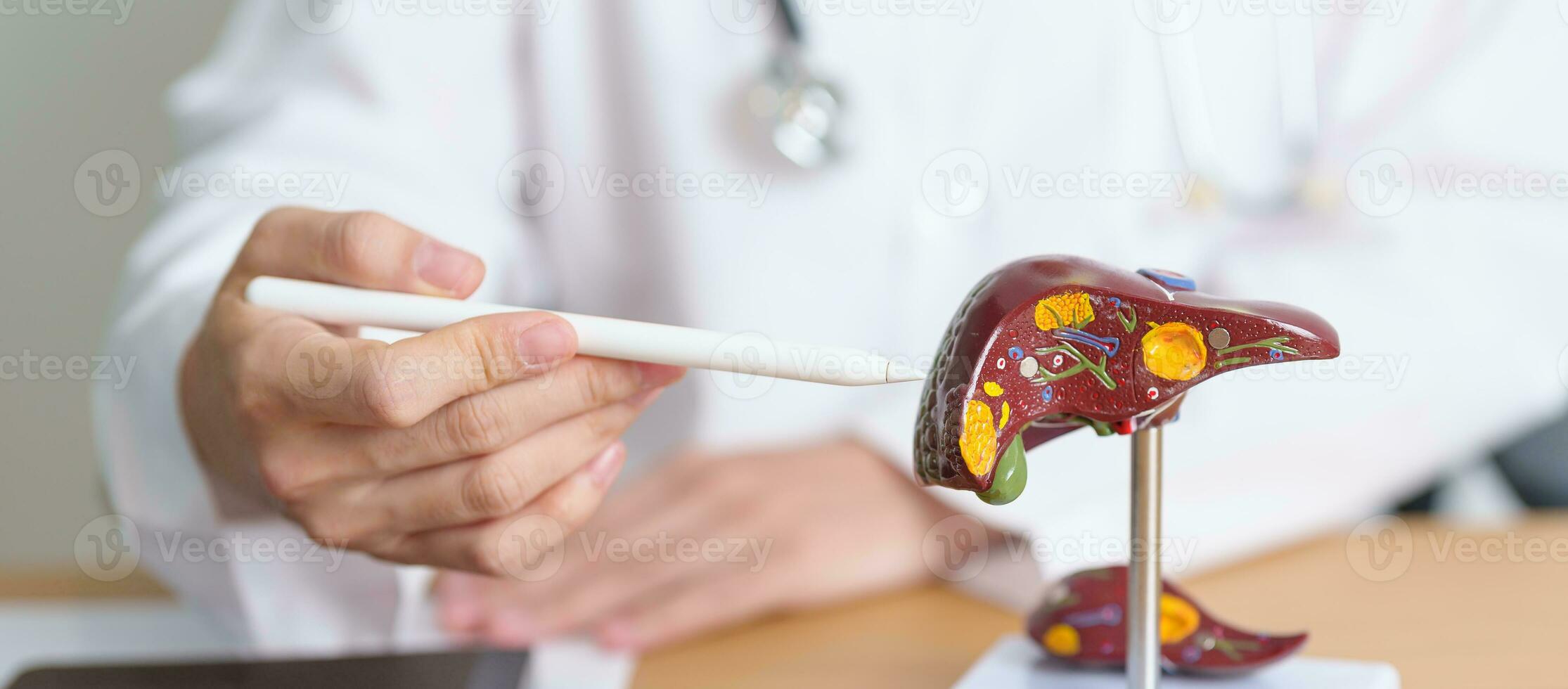 médecin avec Humain foie anatomie modèle. foie cancer et tumeur, jaunisse, viral hépatite un, b, c, d, e, cirrhose, échec, agrandi, hépatique encéphalopathie, ascite fluide dans ventre et santé concept photo