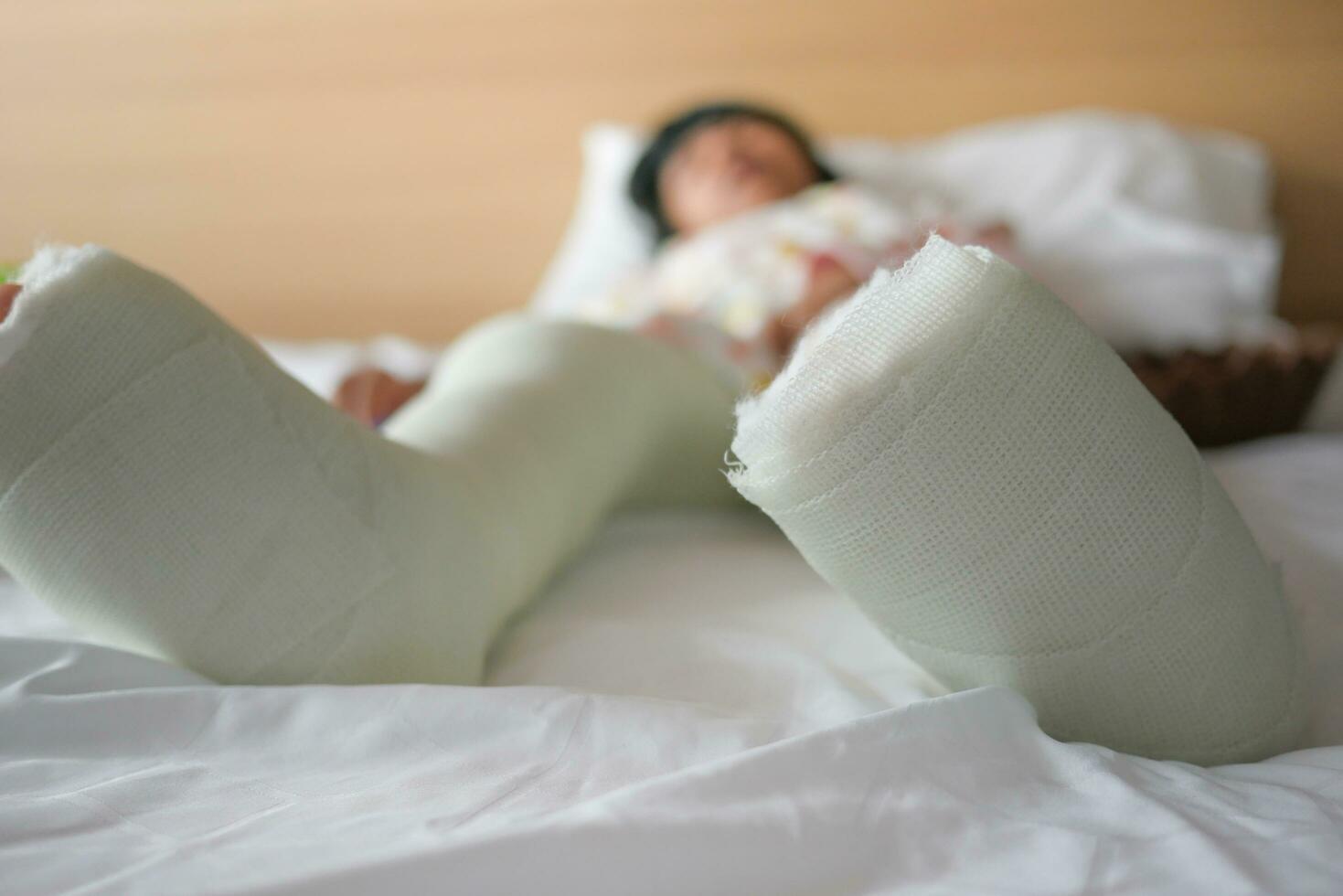 peu enfant avec plâtre bandage sur jambe. photo