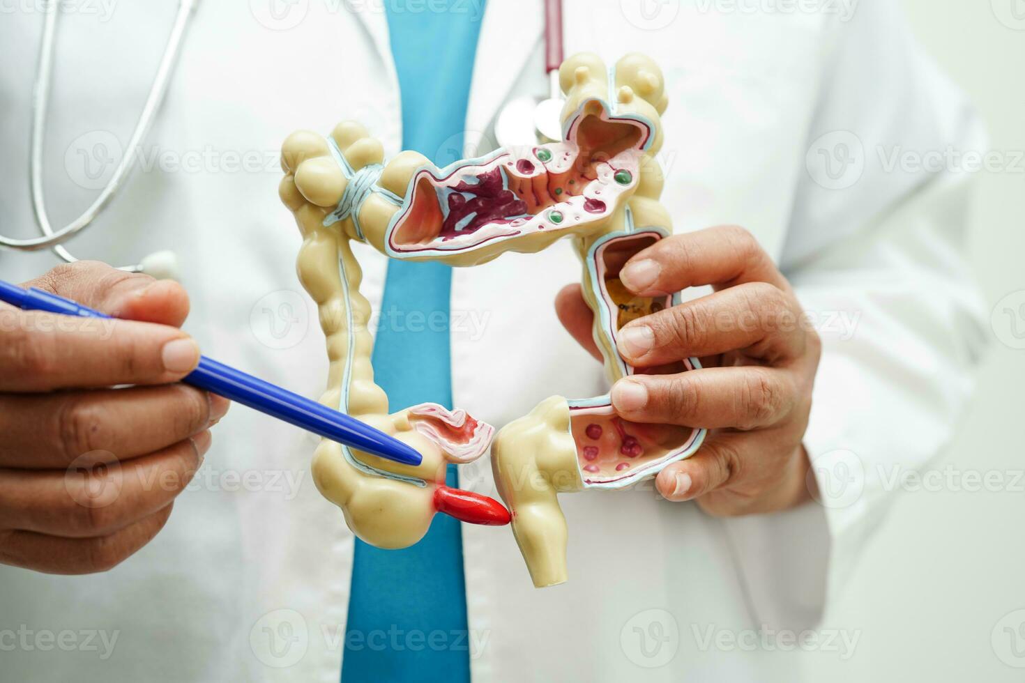 intestin, médecin en portant anatomie modèle pour étude diagnostic et traitement dans hôpital. photo