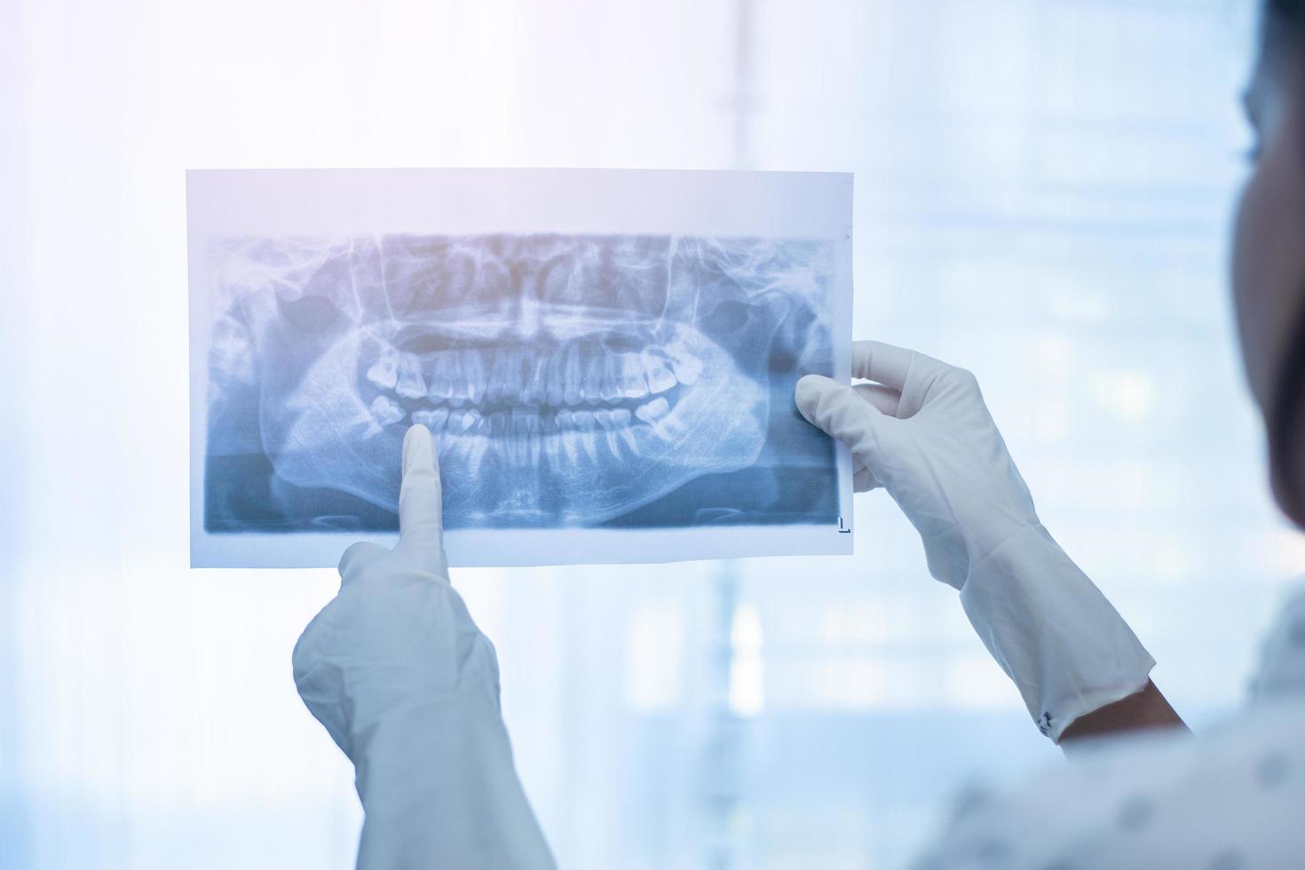 femme dentiste tenant une radiographie dentaire photo