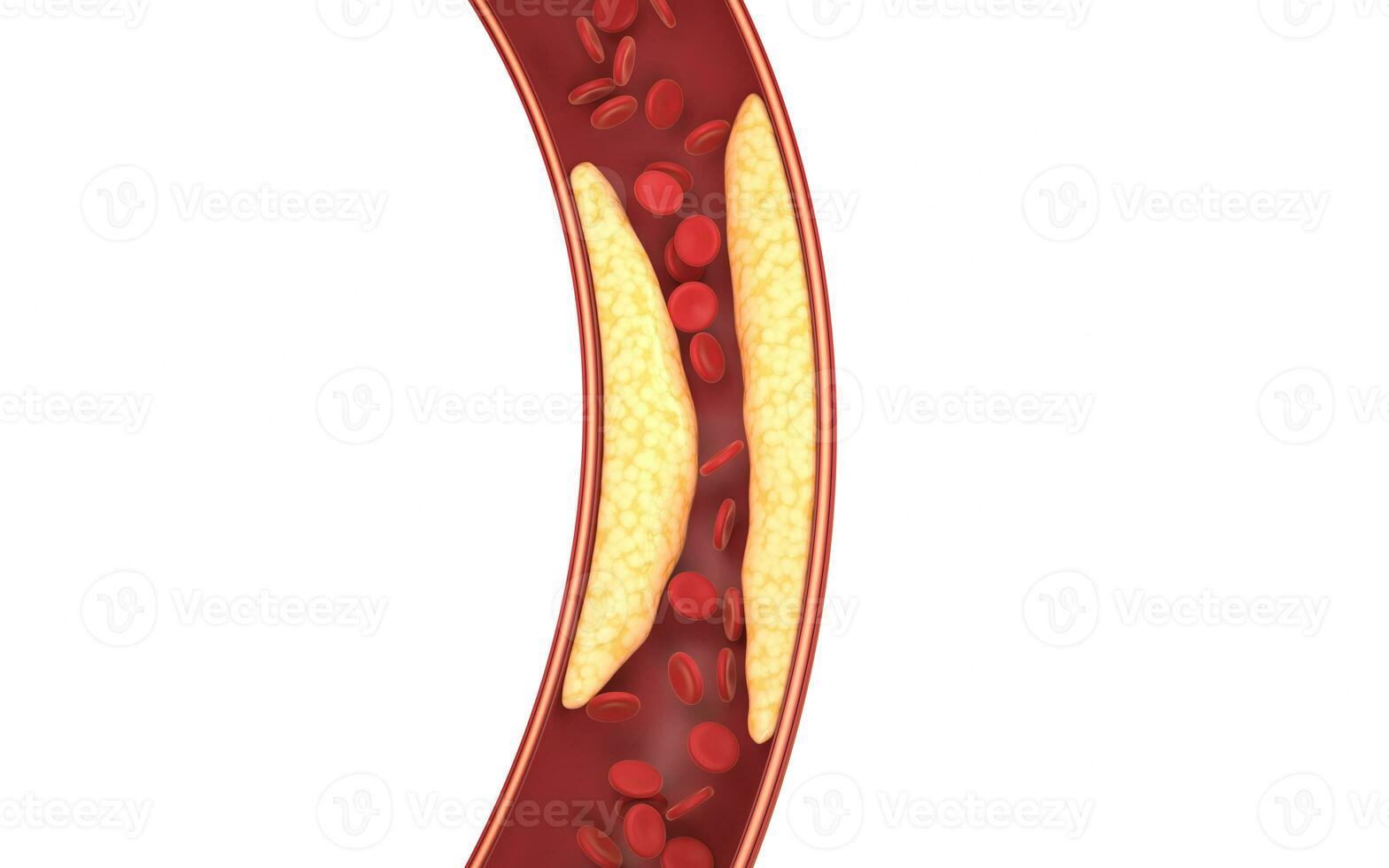 graisse et rouge du sang cellules dans du sang navires, 3d le rendu. photo