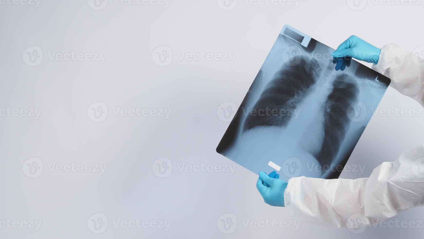 film radiographique des poumons dans les mains des médecins photo