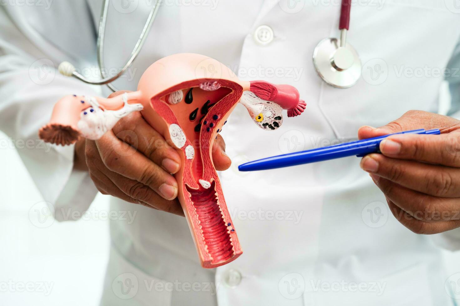 utérus, médecin en portant anatomie modèle pour étude diagnostic et traitement dans hôpital. photo