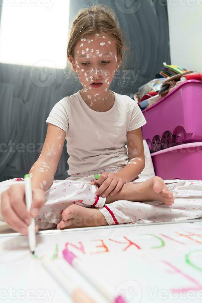 peu école fille avec varicelle dessin sur blanc planche dans enfants' chambre, antiseptique crème appliqué à visage et corps. tableau noir et jouets Contexte. photo