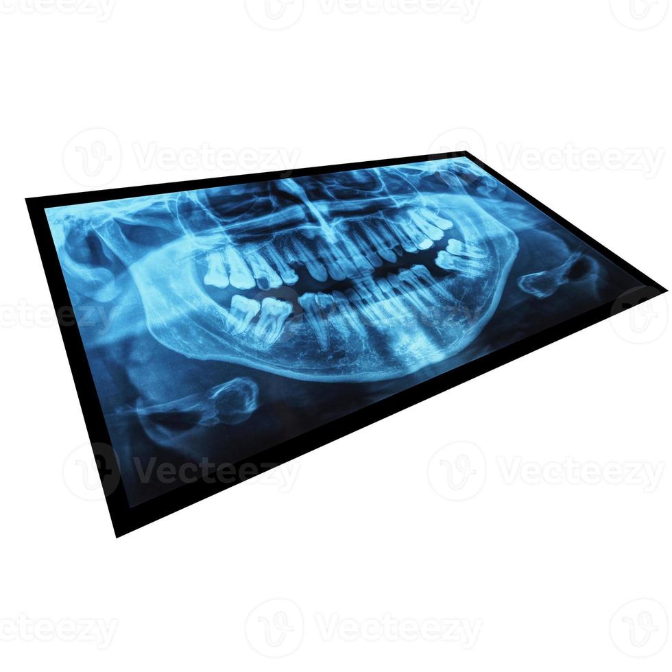 radiographie médicale des dents photo