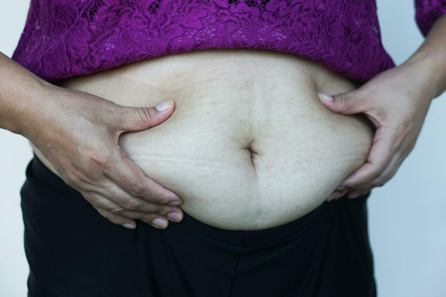 fermer femme mains toucher gros ventre, graisse avec cellulite abdomen. concept, obésité. en surpoids. corps forme problème pour femme après grossesse ou avoir plus ancien. bruyère se soucier. photo