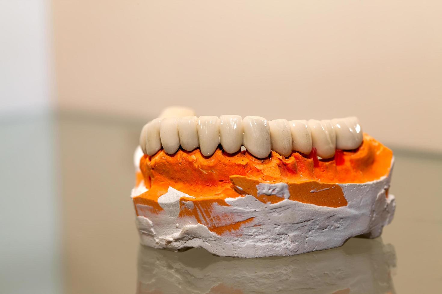 Plaque dentaire en porcelaine de zirconium dans un magasin de dentiste photo