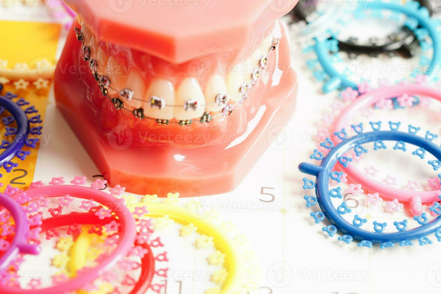 orthodontique ligatures anneaux et cravates, élastique caoutchouc bandes  sur orthodontique croisillons, modèle pour dentiste en train d'étudier à  propos dentisterie. 33269582 Photo de stock chez Vecteezy