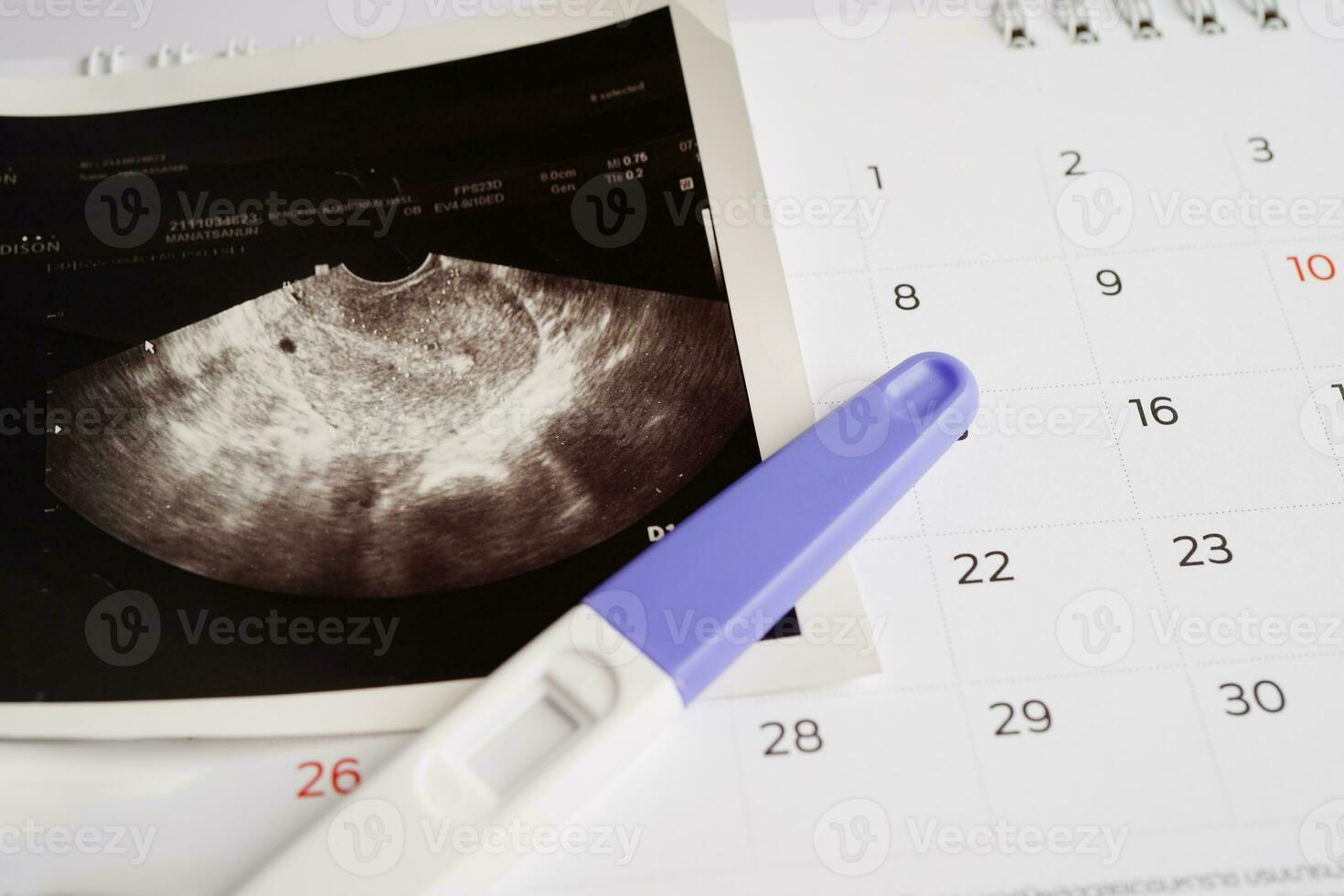 grossesse tester avec ultrason analyse photo de fœtus, maternité, accouchement, naissance contrôle.