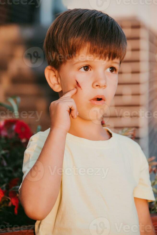 portrait de une magnifique enfant avec une cicatrice sur le sien visage photo