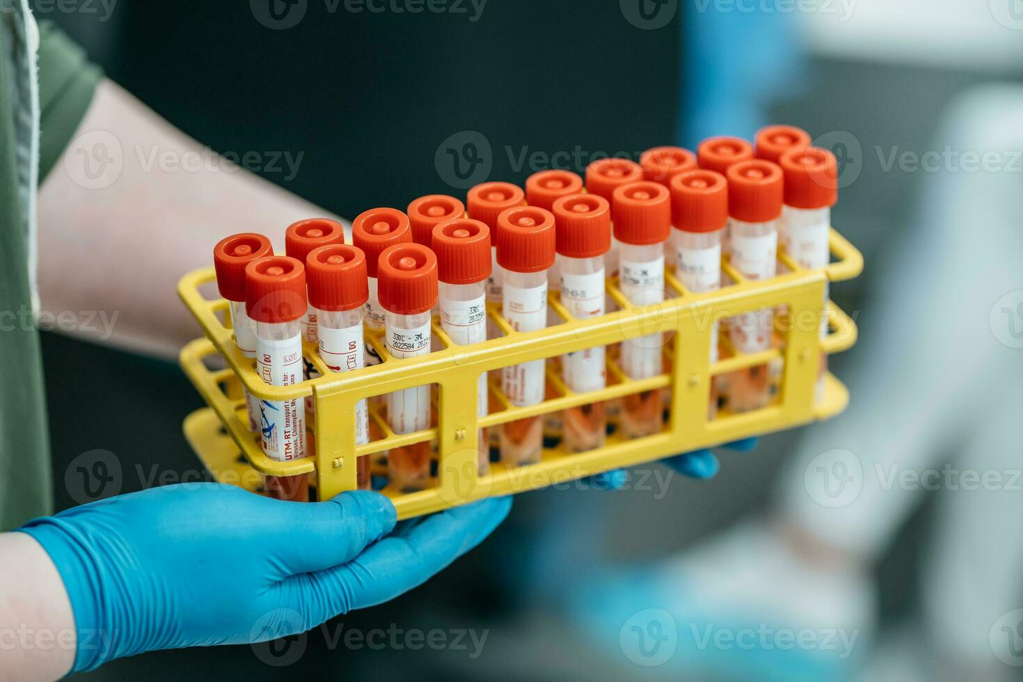 médecin dans le laboratoire détient tester tubes avec pcr tester résultats photo