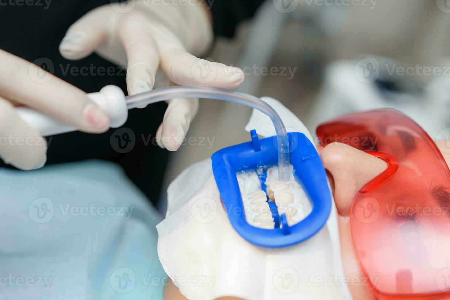 en train de préparer le oral cavité pour blanchiment avec un ultra-violet lampe. fermer photo