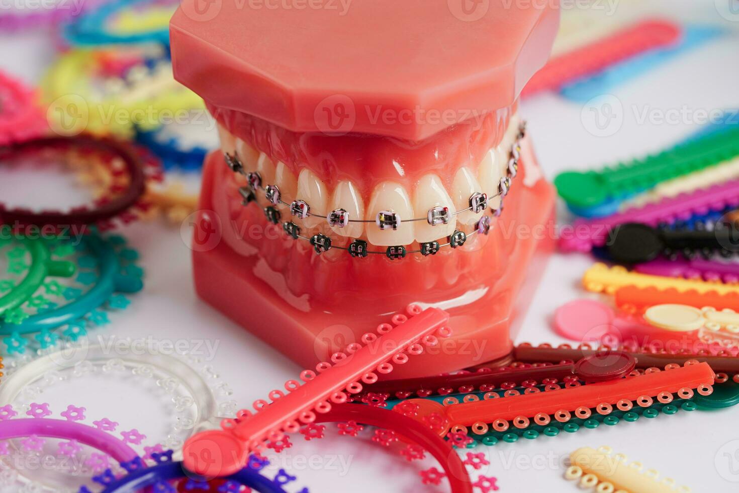 orthodontique ligatures anneaux et cravates, élastique caoutchouc bandes  sur orthodontique croisillons, modèle pour dentiste en train d'étudier à  propos dentisterie. 35746940 Photo de stock chez Vecteezy