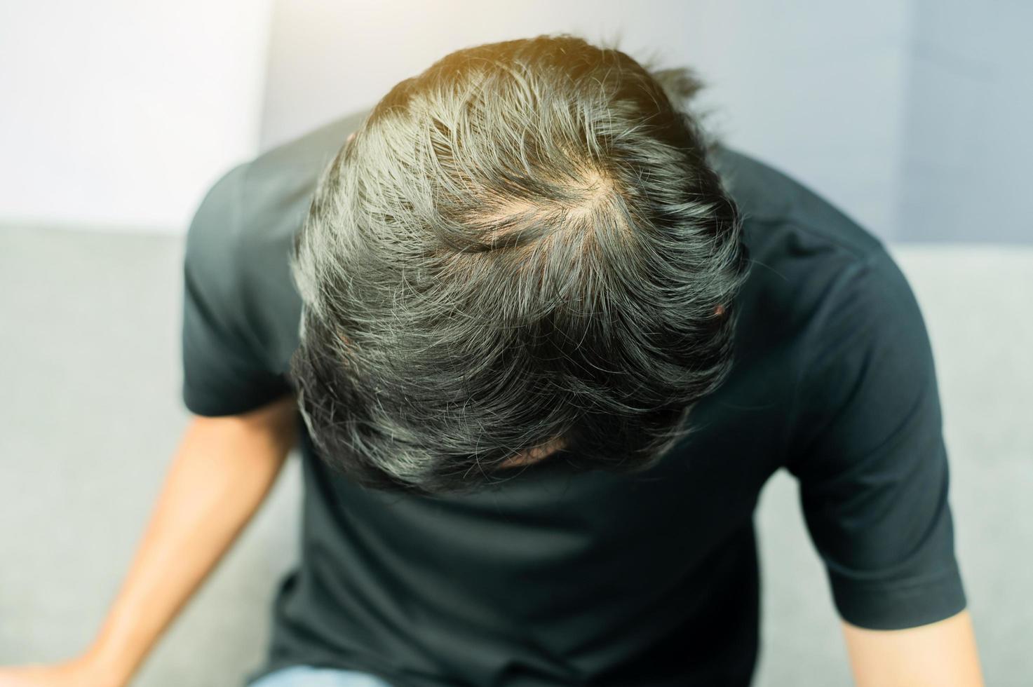 les hommes ont des problèmes de perte de cheveux, de cheveux clairsemés, de calvitie photo