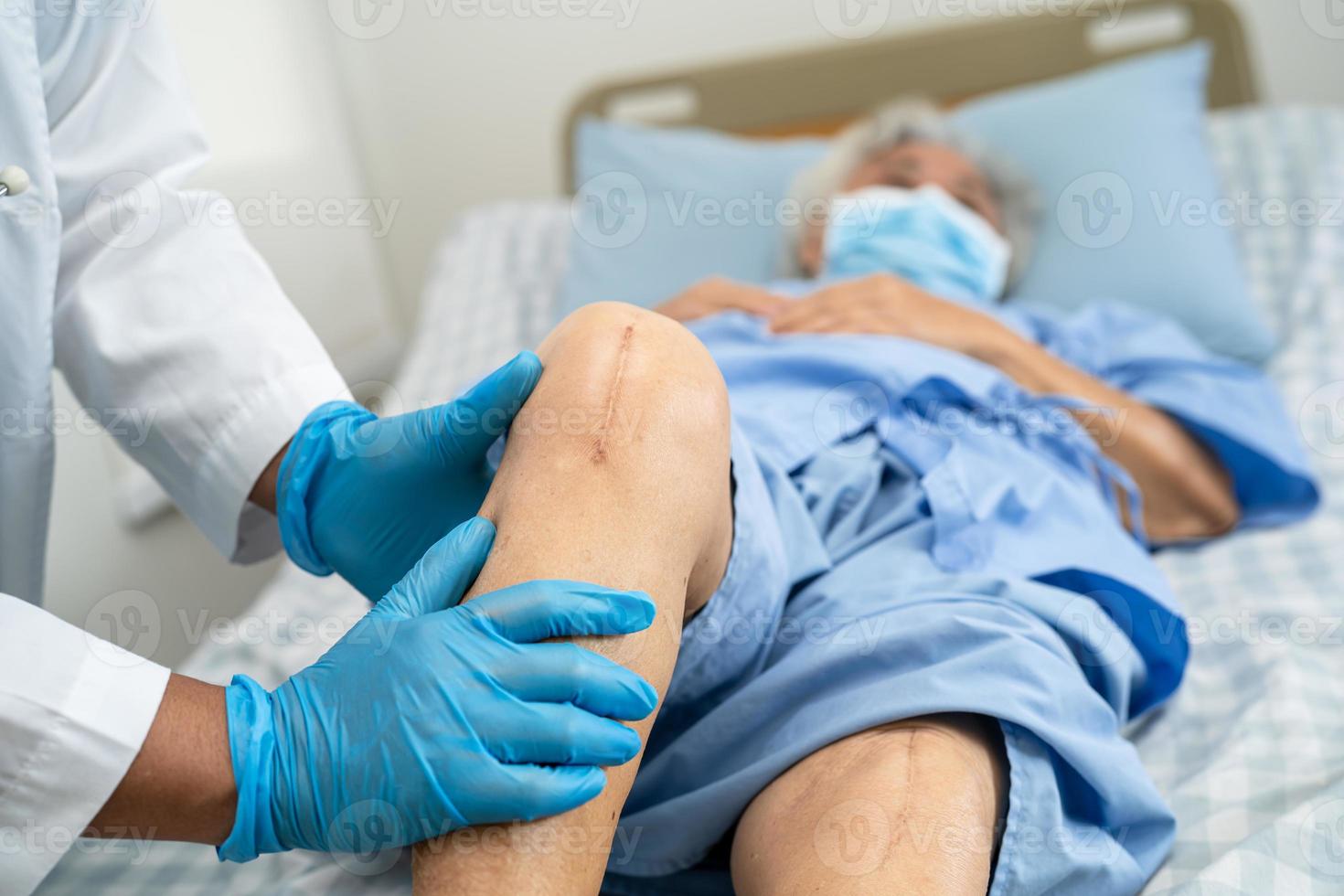 Une patiente asiatique âgée ou âgée montre ses cicatrices Chirurgie de remplacement total de l'articulation du genou Chirurgie des plaies arthroplastie sur lit dans la salle d'hôpital de soins infirmiers, concept médical solide et sain. photo