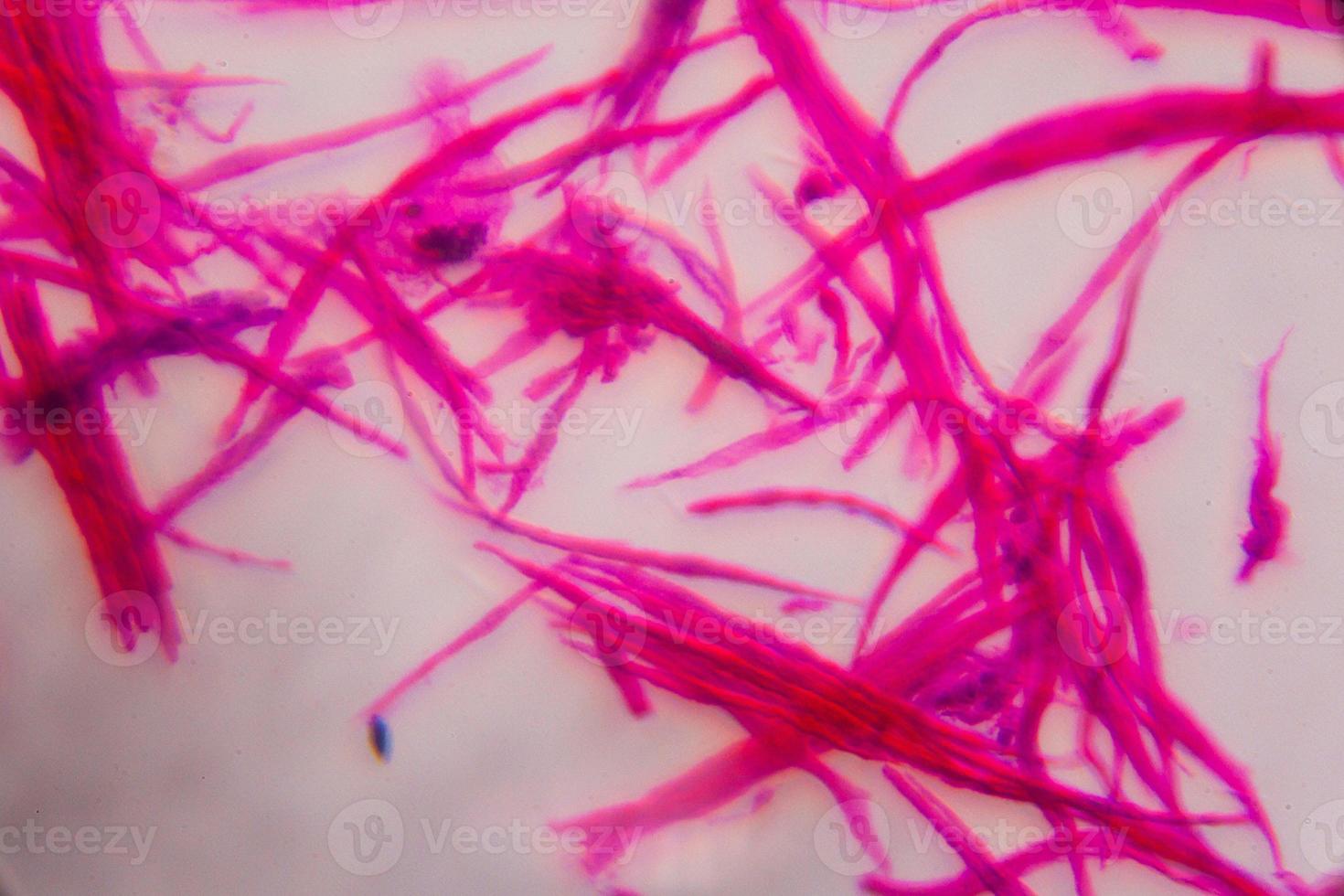 muscle lisse séparé au microscope - lignes roses abstraites sur fond blanc photo