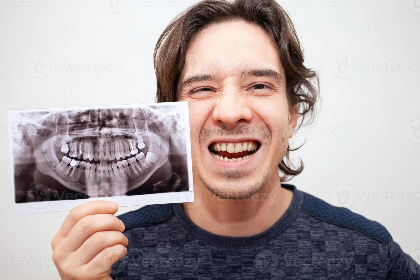 radiographie de les dents photo. homme sourires, ouvre le sien bouche. pose, portrait. isolé photo