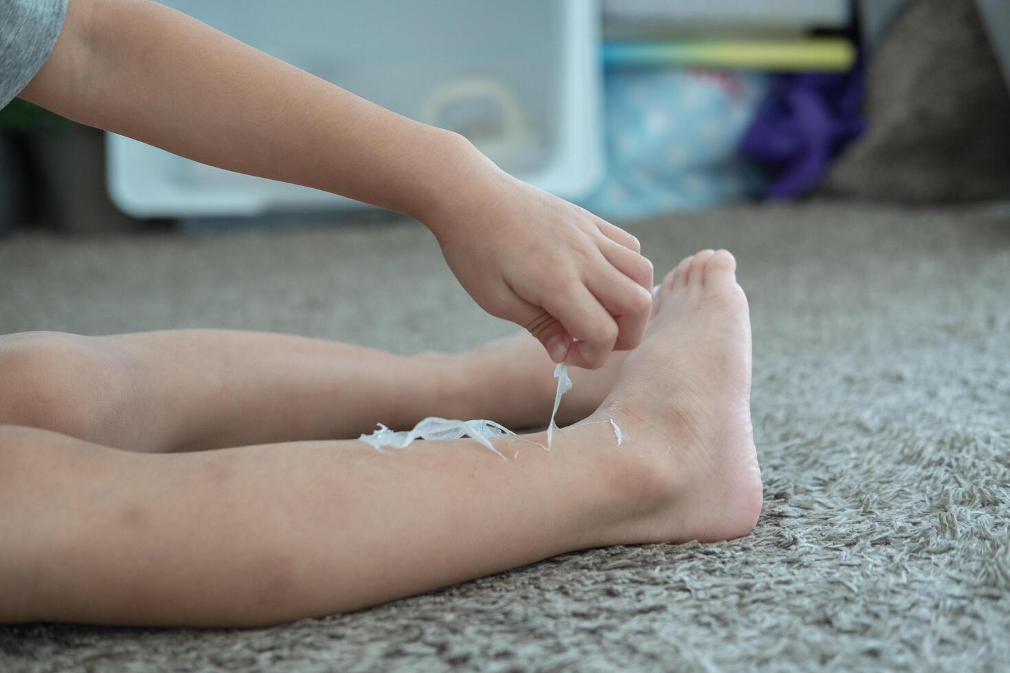 peu asiatique garçons mains peeling de sec peau sur le sien jambes. peau problèmes. photo