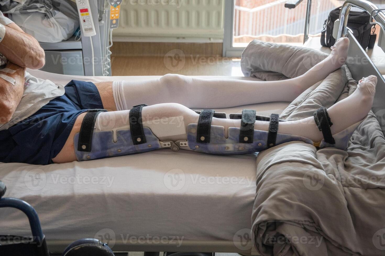 une homme avec une cassé jambe dans un orthèse sur une lit dans une clinique après un accident et une fracture de le fémur photo