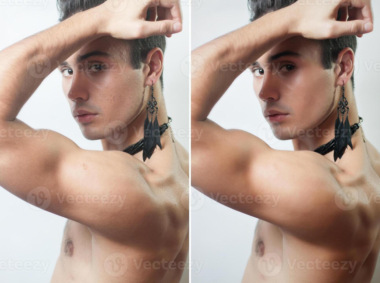 avant et après cosmétique opération. Jeune homme portrait photo