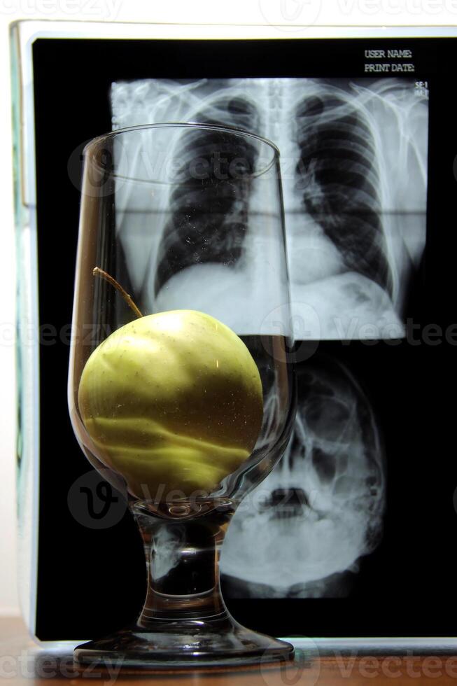 médical symboles. Pomme de connaissance dans verre dans de face de radiographie radiographie image de cortex une analyse photo