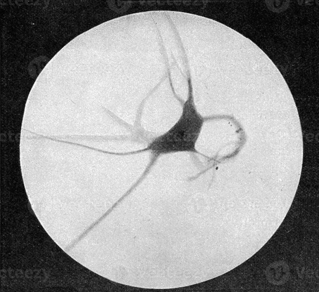 nerf cellule avec modérément grand excroissances, ancien gravure. photo