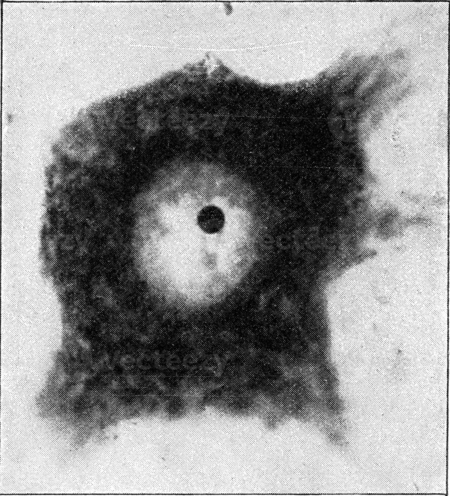 nerf cellule avec ses noyau et une petit corpuscule noyau très fortement agrandi, ancien gravure. photo