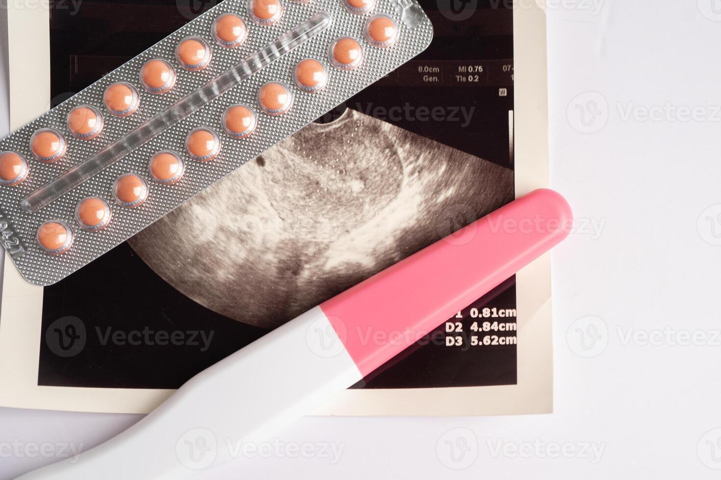 grossesse tester et naissance contrôle pilules avec ultrason analyse de bébé utérus, la contraception santé et médicament. photo