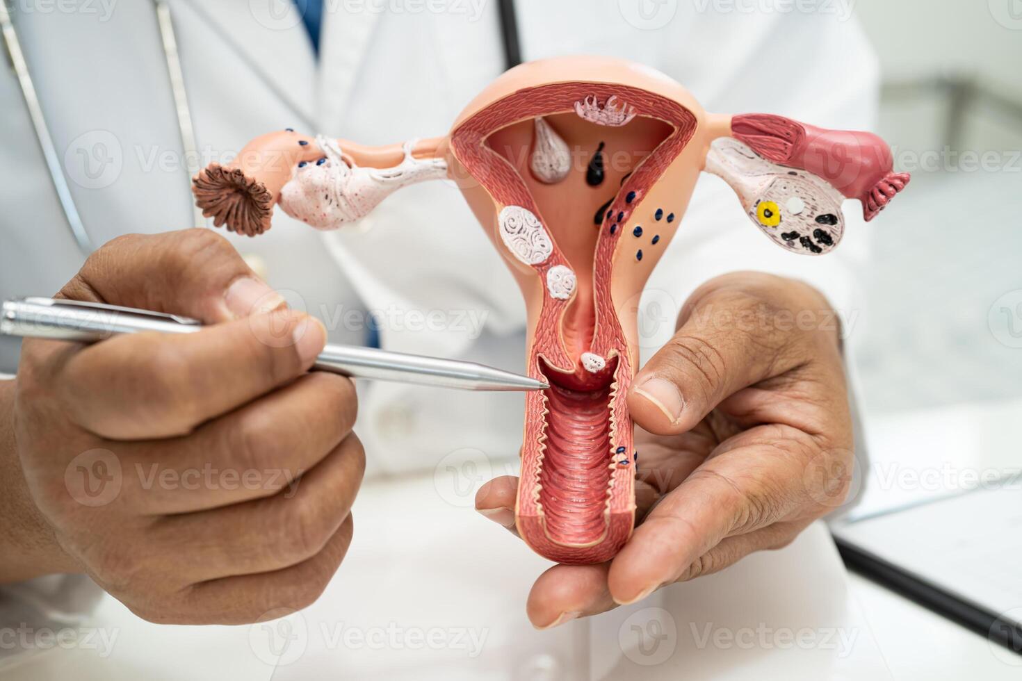 utérus, médecin avec anatomie modèle pour étude diagnostic et traitement dans hôpital. photo