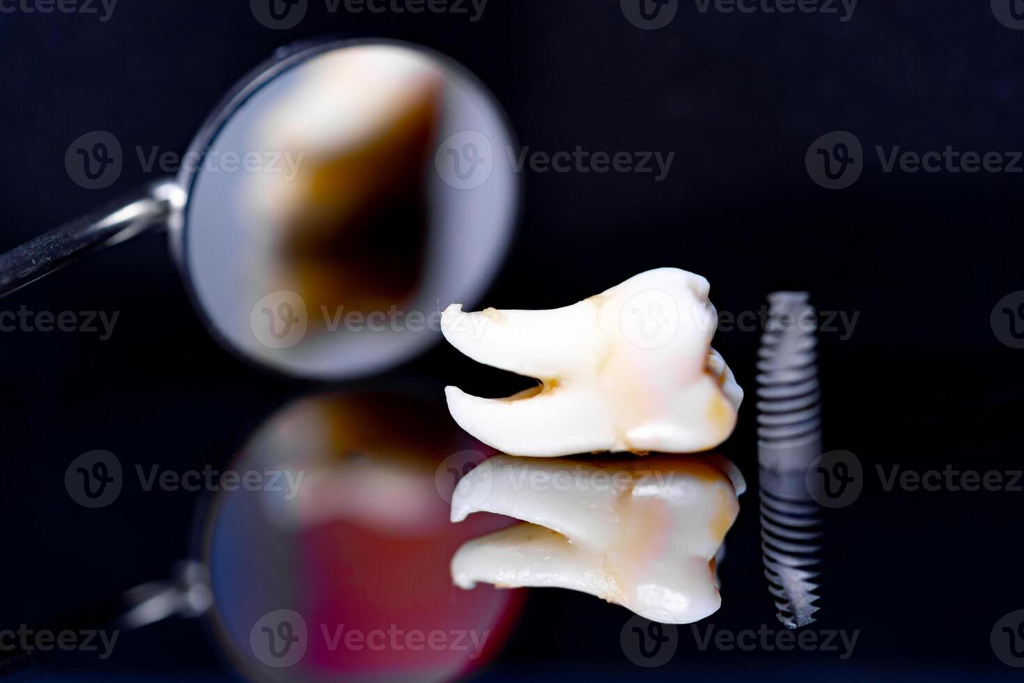 dentaire implant modèle sur noir Contexte et dentaire miroir. photo