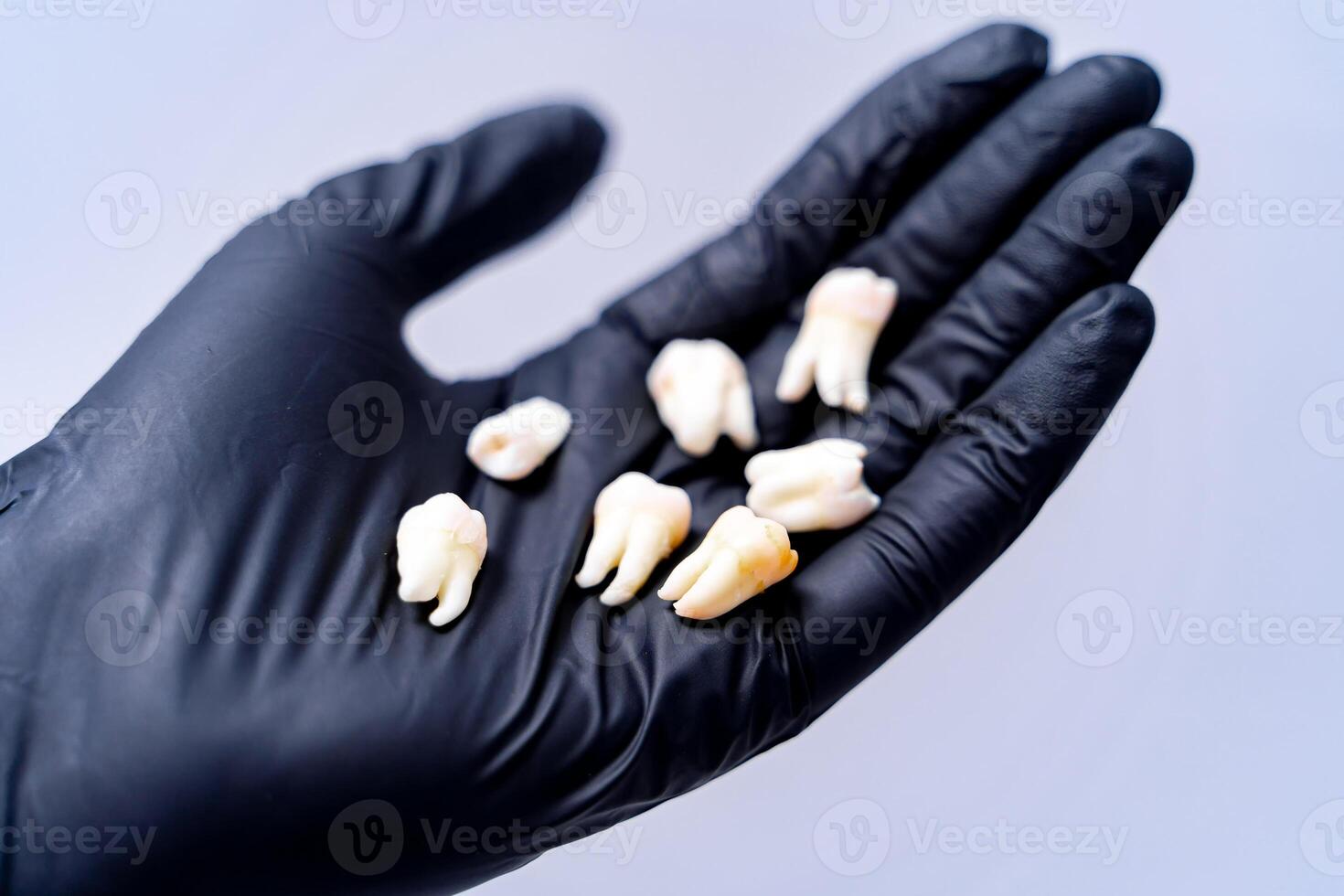 céramique dentaire les implants. photo