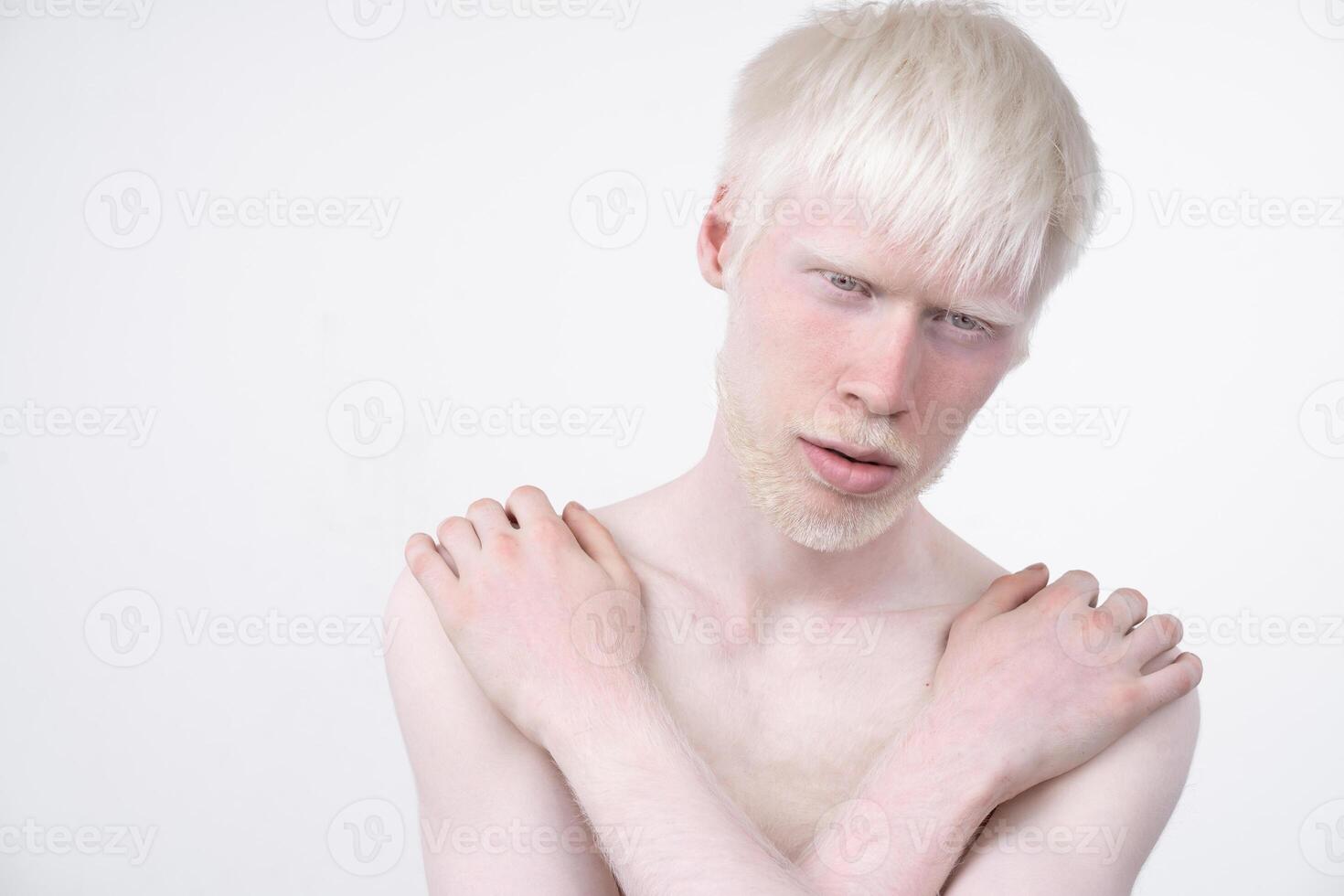 portrait de un albinos homme dans studio habillé T-shirt isolé sur une blanc Contexte. anormal déviations. inhabituel apparence photo