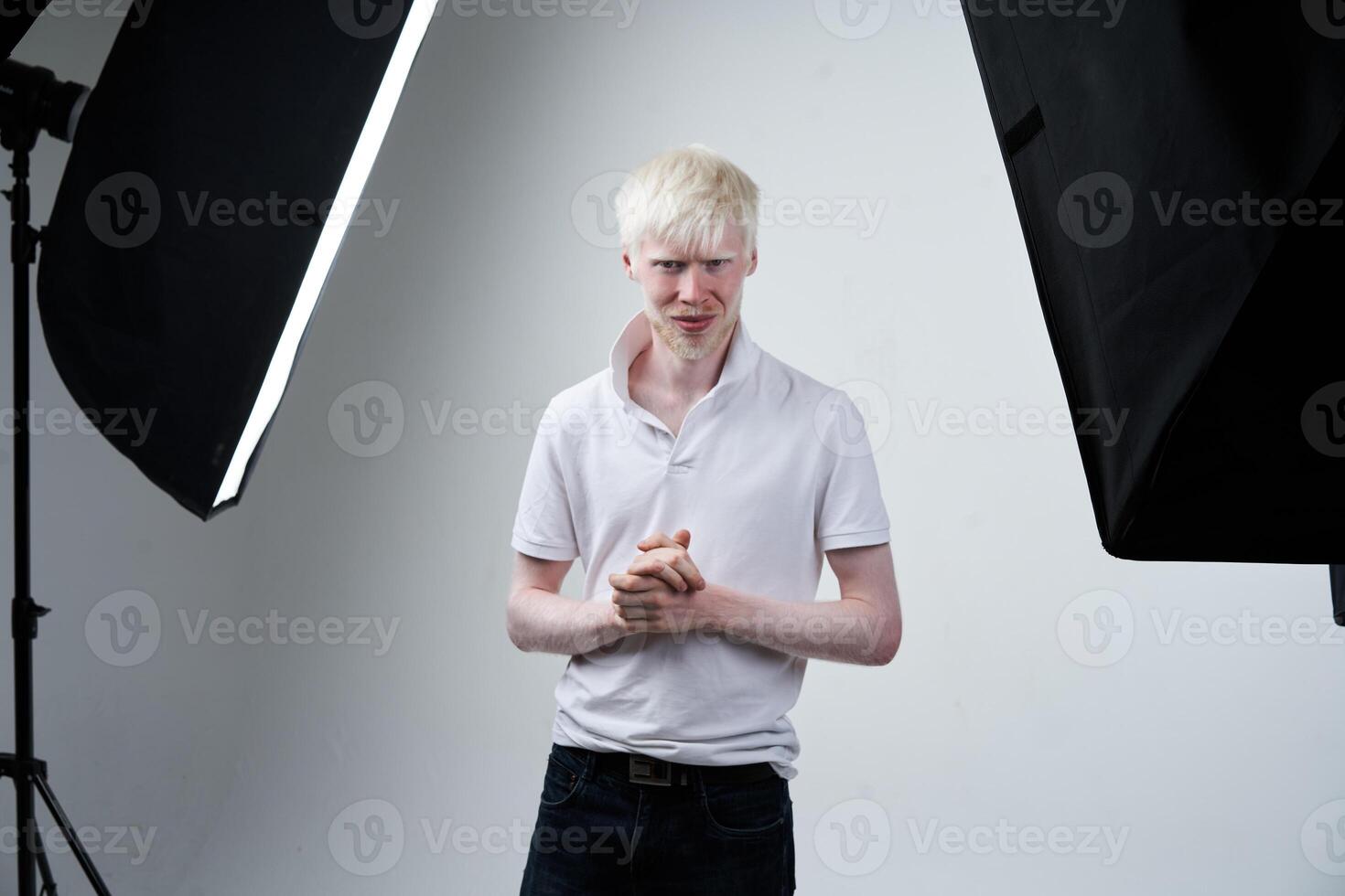 albinisme albinos homme dans studio habillé T-shirt isolé sur une blanc Contexte. anormal déviations. inhabituel apparence photo