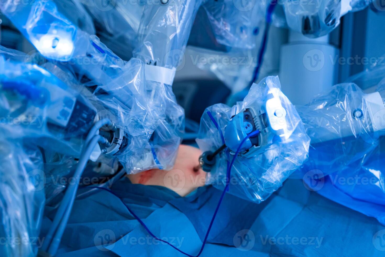 médical robotique chirurgie machine da Vinci. Manuel contrôle par au minimum envahissant chirurgical système. moderne automatique médical appareil. machine bras neurochirurgien. fermer de neurochirurgie machine. photo