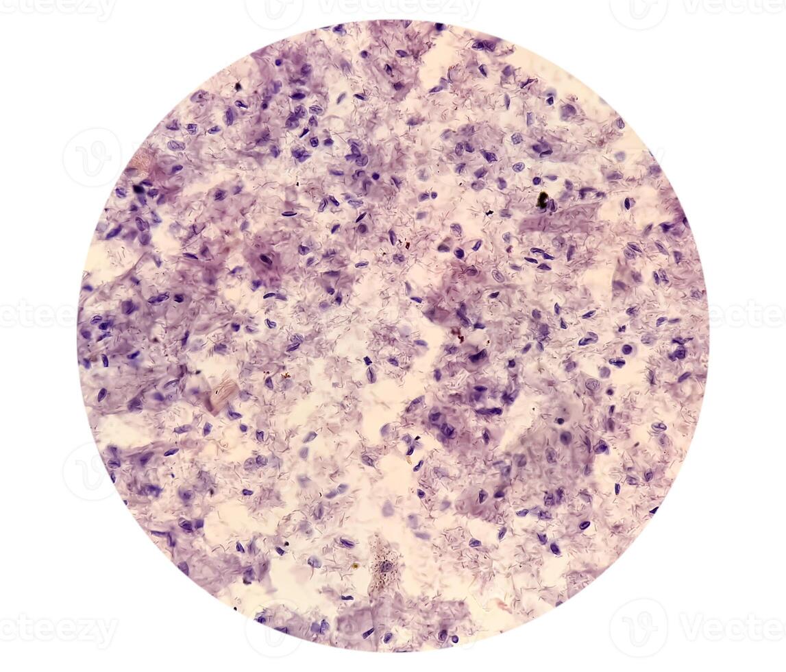 trichomonas vaginale est un anaérobie, flagellé protozoaire parasite et le causal agent de trichomonase. photo