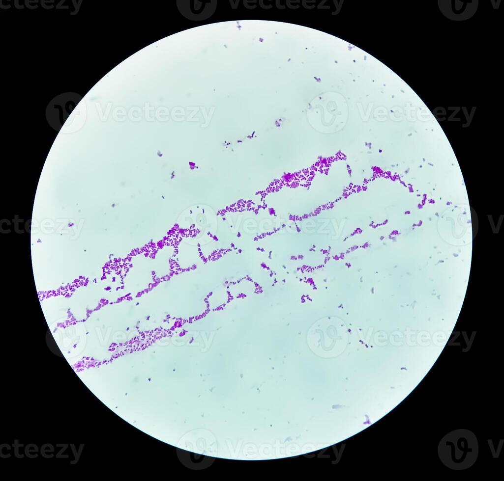 pus gramme coloré microscopique montrant gramme positif bactéries. photo