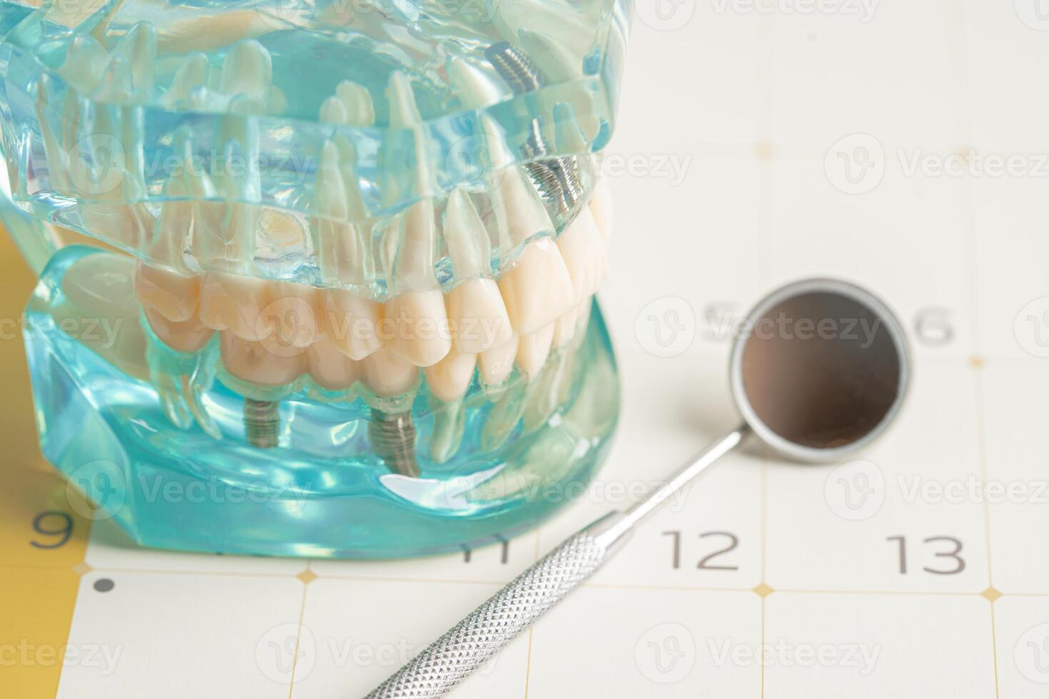 dentaire implant, artificiel dent les racines dans mâchoire, racine canal de dentaire traitement, gencive maladie, les dents modèle pour dentiste en train d'étudier à propos dentisterie. photo