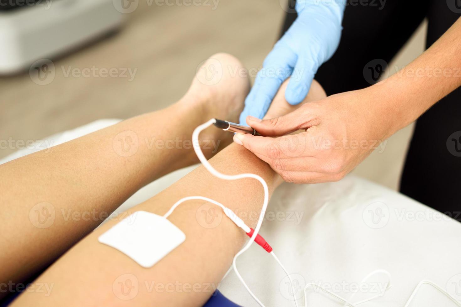 électroacupuncture sèche avec une aiguille sur la cheville féminine. photo