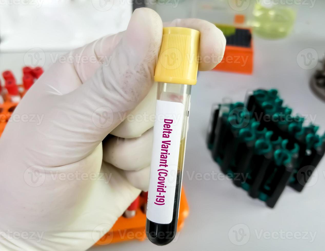 technicien tenant un tube de test sanguin identifié avec l'étiquette covid-19 variante delta. médecin avec un échantillon de sang positif pour la nouvelle variante détectée de la souche de coronavirus appelée delta photo