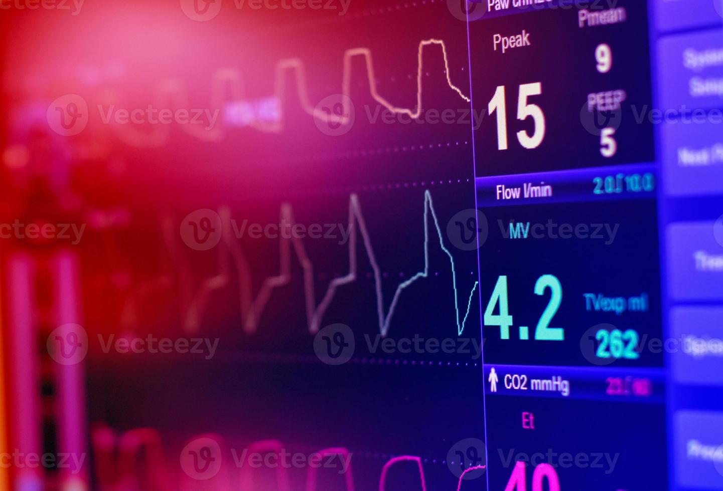 examinez l'ekg dans une pompe à ballon intraveineuse dans l'icu sur un arrière-plan flou. ondes cérébrales dans les ondes cérébrales ondes de fréquence cardiaque. photo