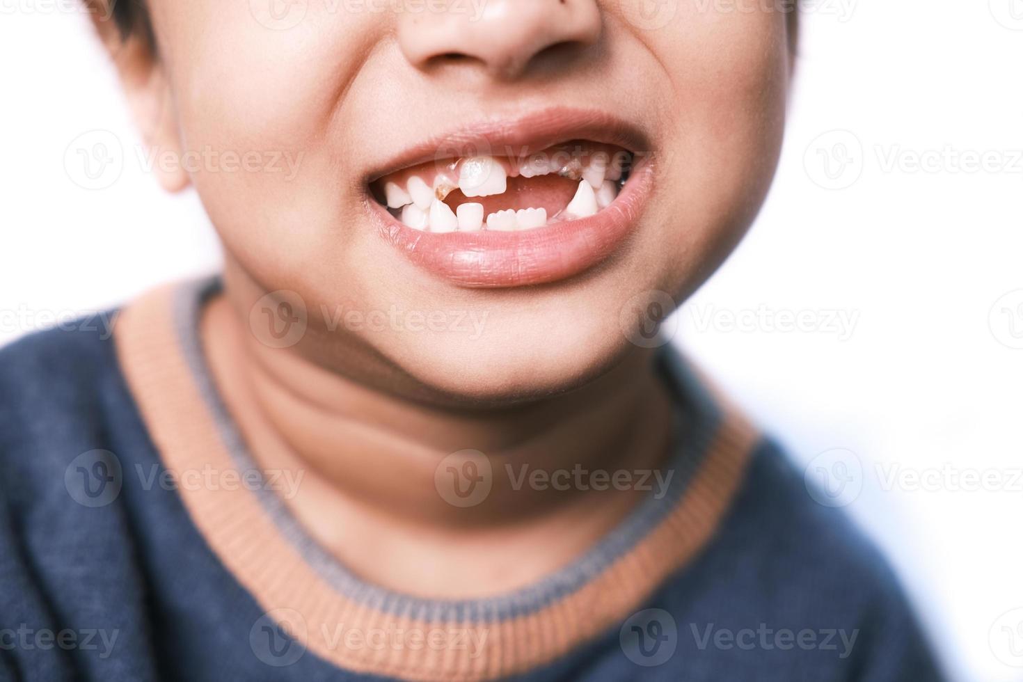 enfant avec une dent abandonnée photo