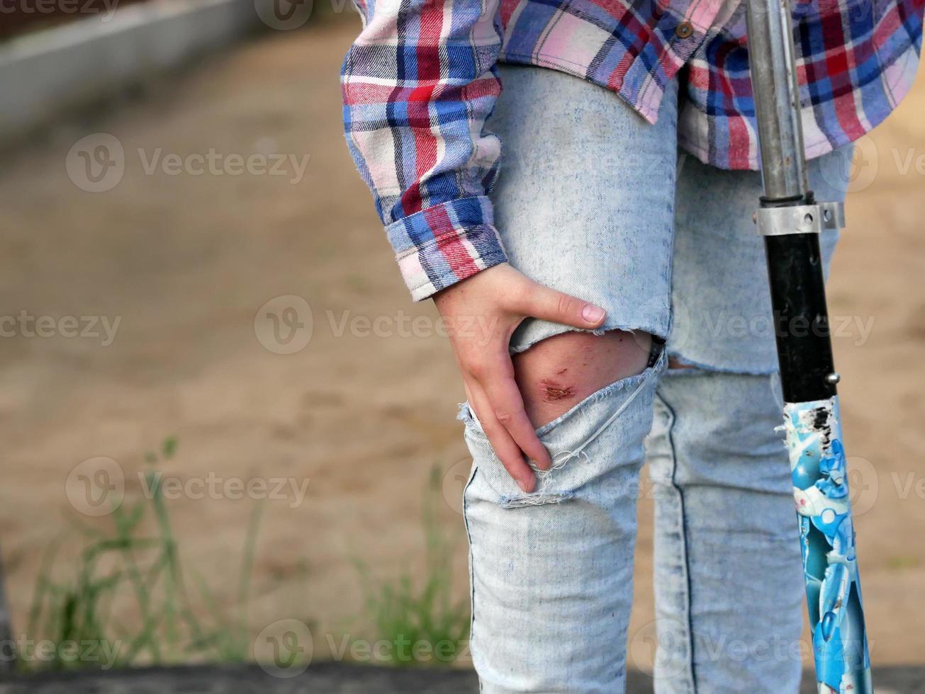 la fille tient sa main sur la jambe blessée photo