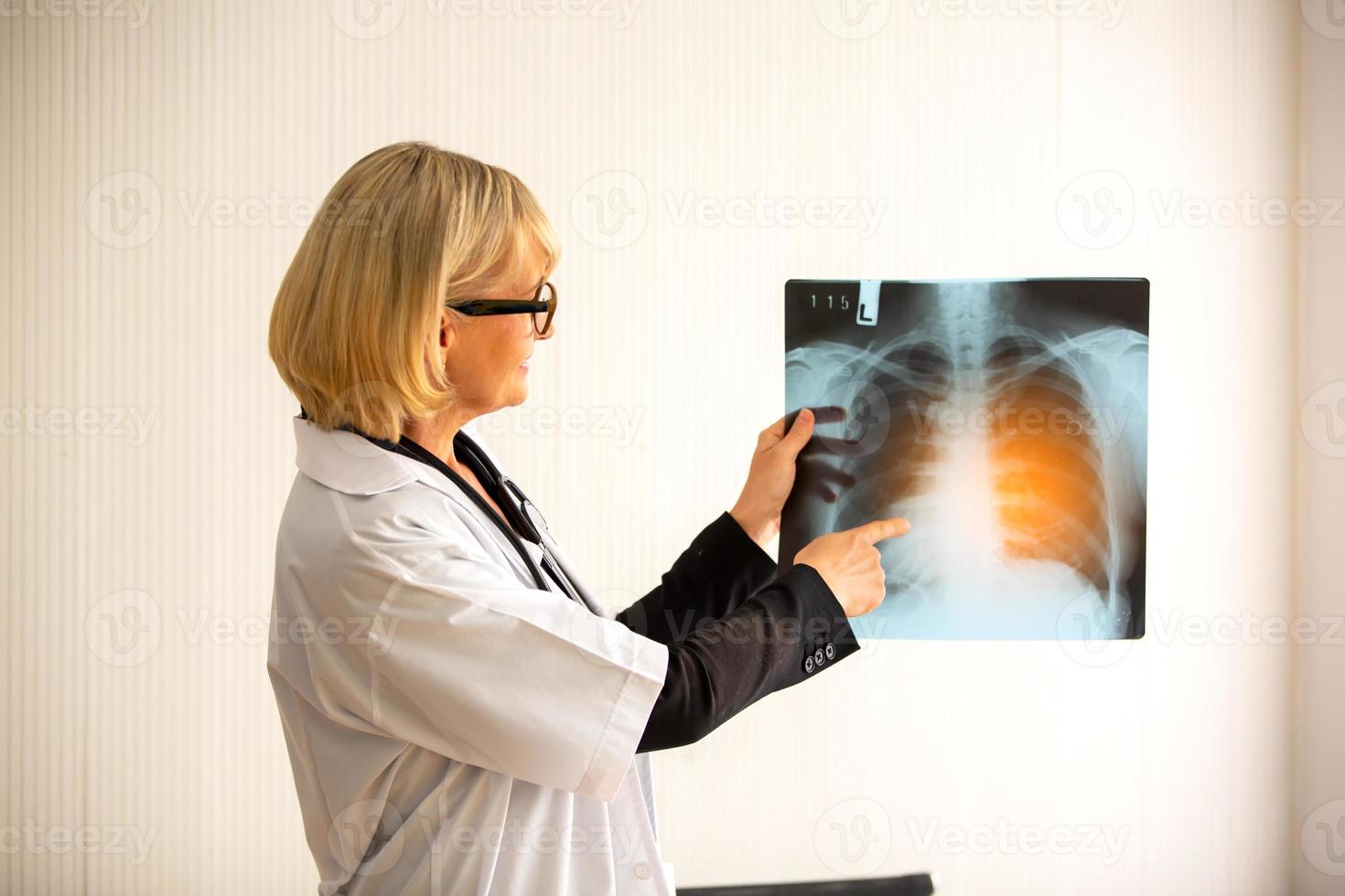 une femme médecin montre l'image d'un film radiographique à une patiente et lui explique. photo