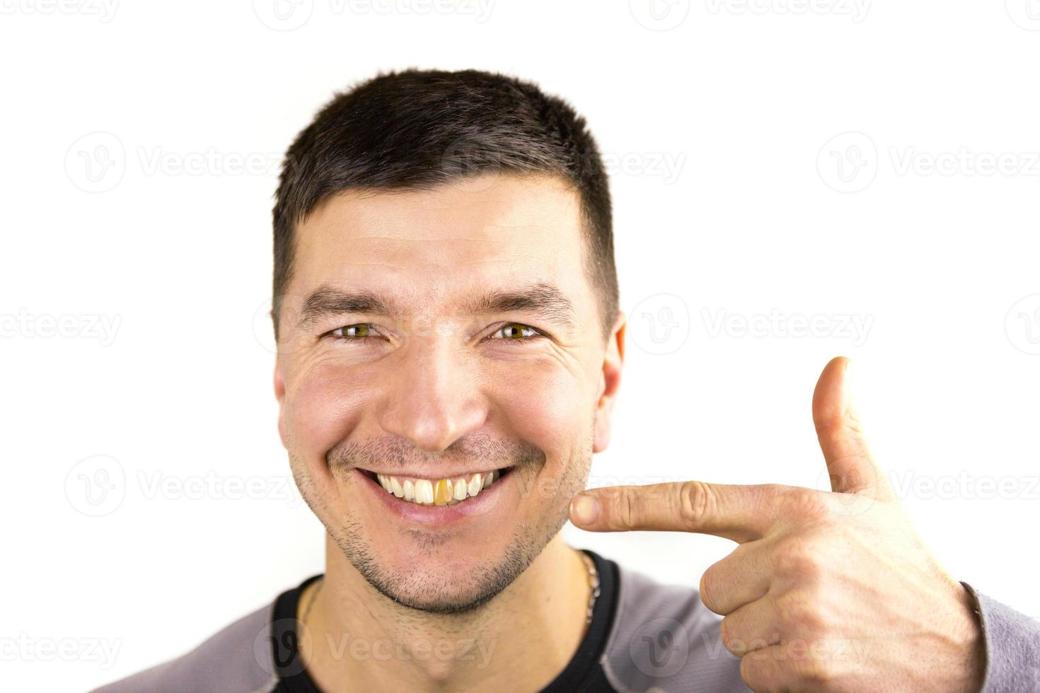 dent endommagée jaune d'un homme caucasien souriant en gros plan. se concentrer sur les dents. problèmes dentaires, dents mortes, blanchiment de l'émail, restauration esthétique. émail naturel, corps positif photo