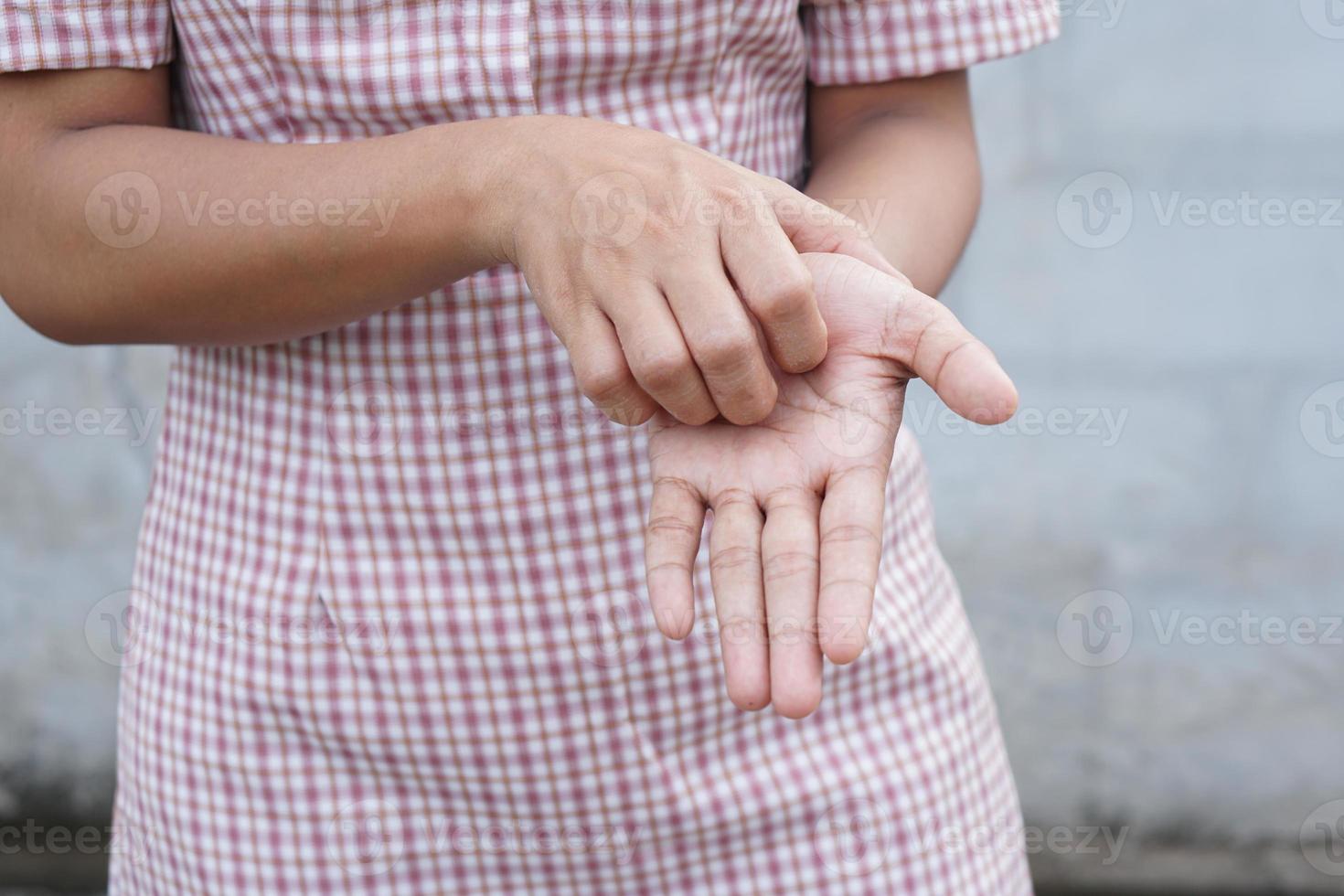 femme se grattant le bras de démangeaisons sur fond gris clair. la cause des démangeaisons de la peau comprend les piqûres d'insectesconcept de la peau des soins de santé. photo