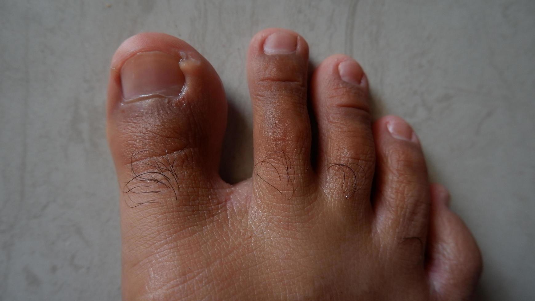 photo des pieds et des orteils d'un homme