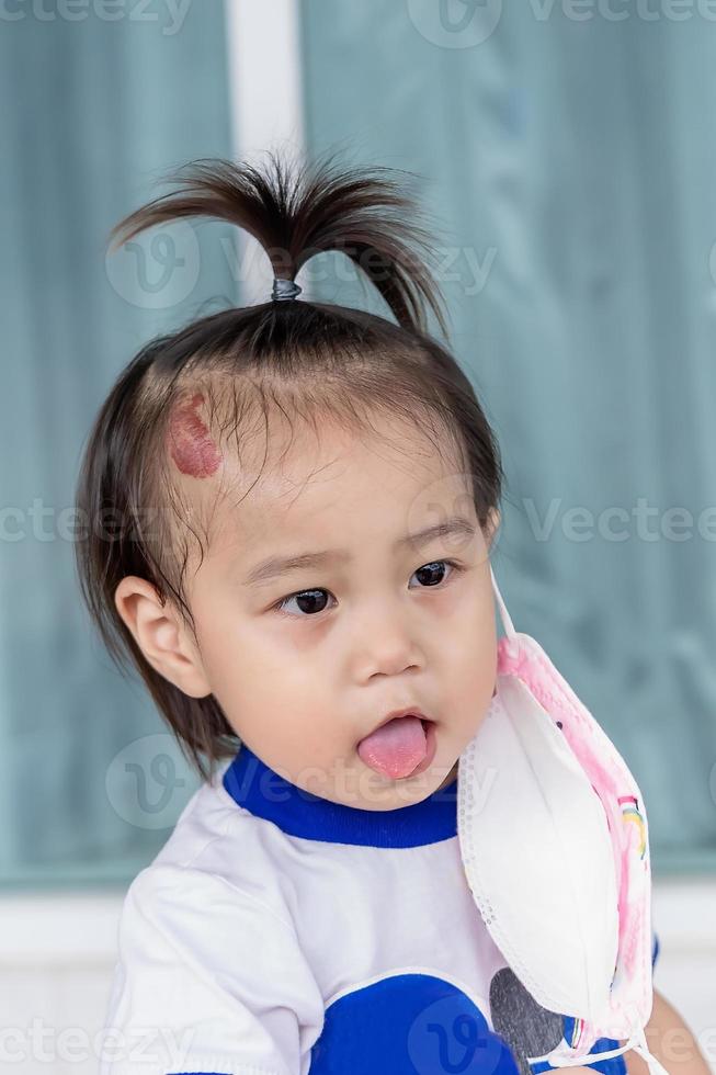 adorable petite fille avec de gros hémangiomes capillaires à la fraise rouge sur la tête refuse de porter un masque médical que la mère ou le tuteur essaient de mettre sur le visage. notion de soins de santé photo