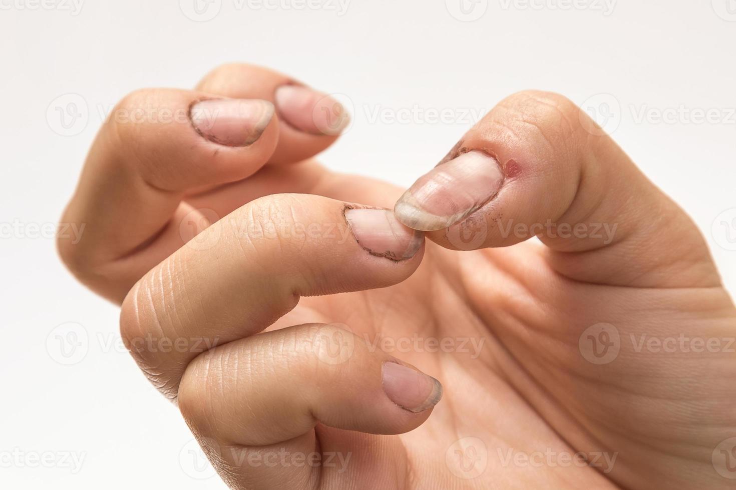 mains féminines avec des ongles sales photo