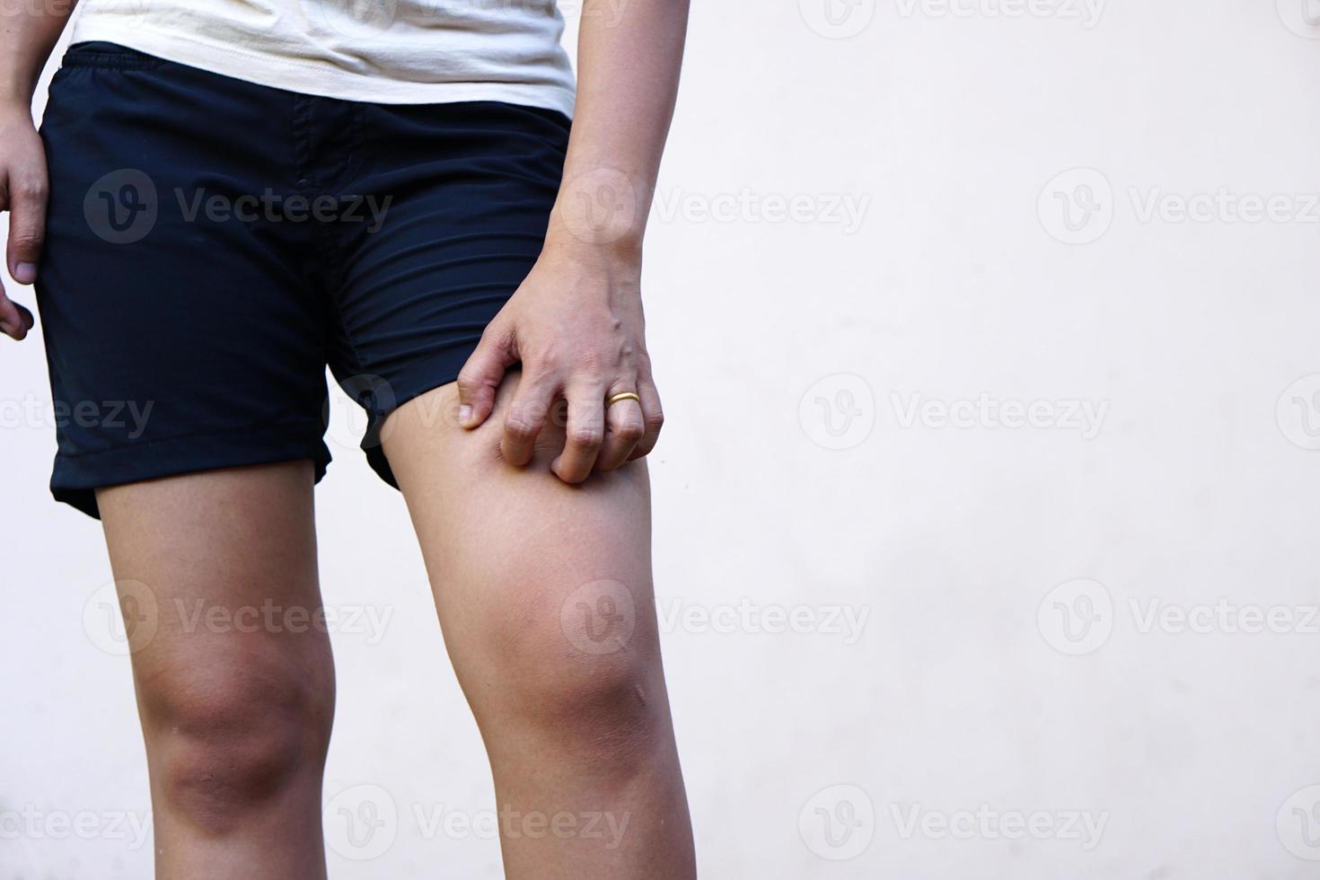 les femmes asiatiques ont des démangeaisons aux jambes. photo