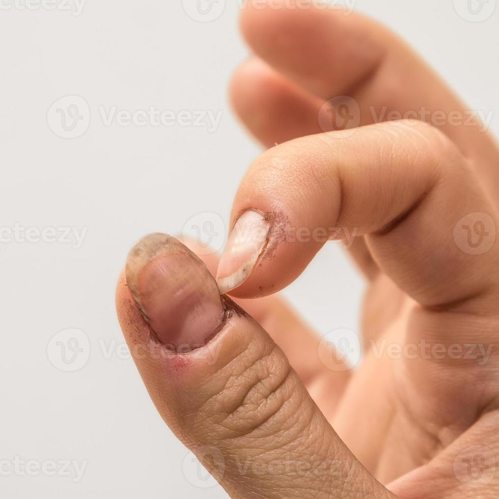 mains féminines avec des ongles sales photo